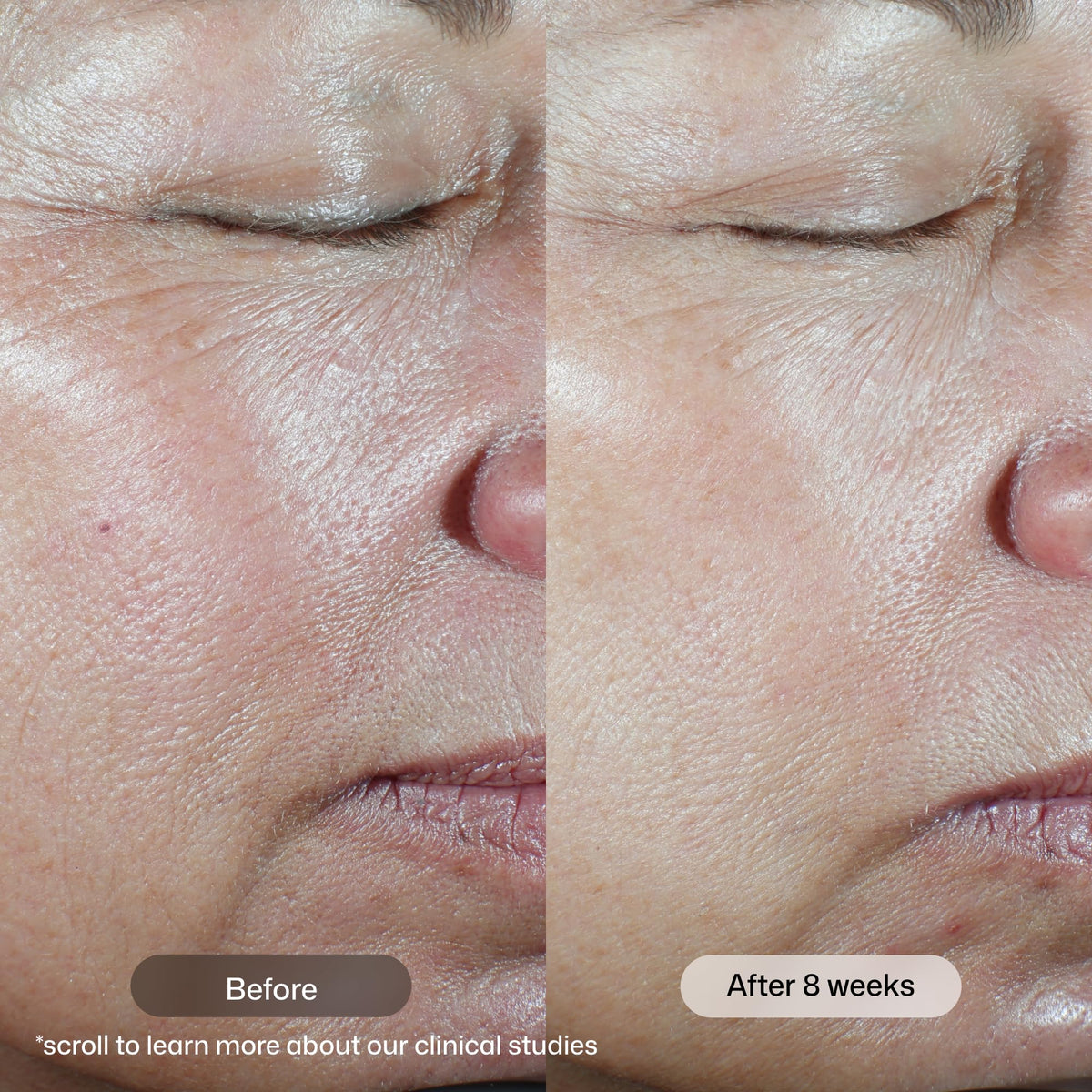 Revision Skincare C Correcting Complex 30 Vitamin C Serum 0 - Revision Skincare Official Imagery - 4