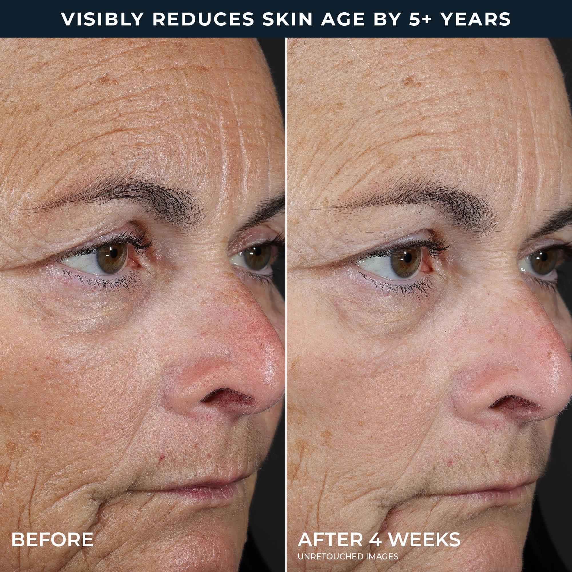 RoC Retinol Correxion facial peel pads for smoothing fine lines, shown with open peel pads and applicator in a close-up shot.