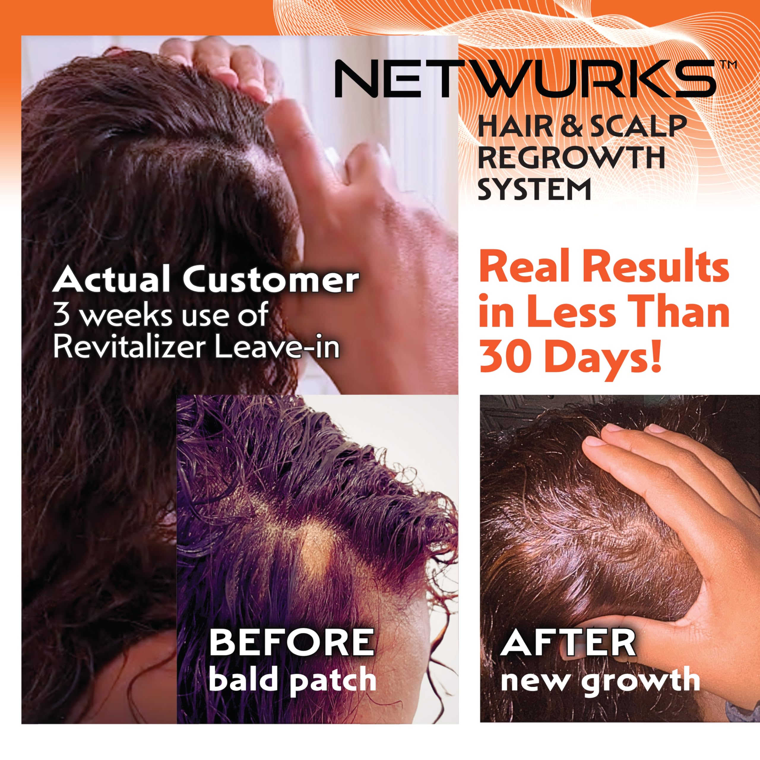 Netwurks Hair & Scalp Bonding Oil | Repairs & Moisturizes Hair Structure with Essential Oils | Promotes a Healthier Scalp & Hair Growth | 2 Oz