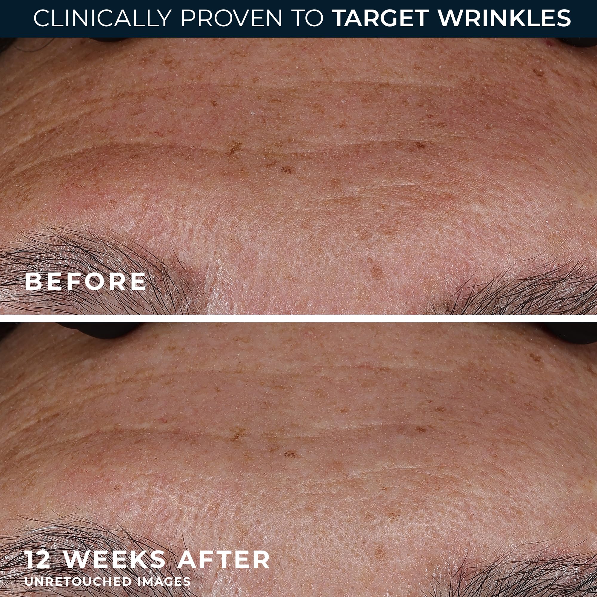 RoC Retinol Correxion Deep Wrinkle Retinol Face Serum - RoC Official Imagery - 6