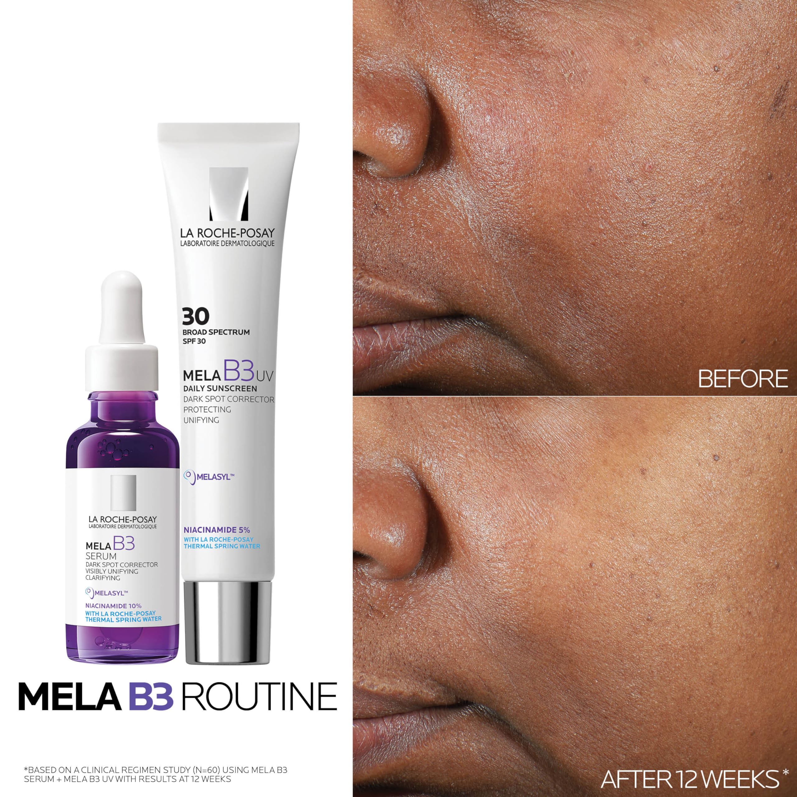 La Roche-Posay Mela B3 Dark Spot Serum 10% Niacinamide