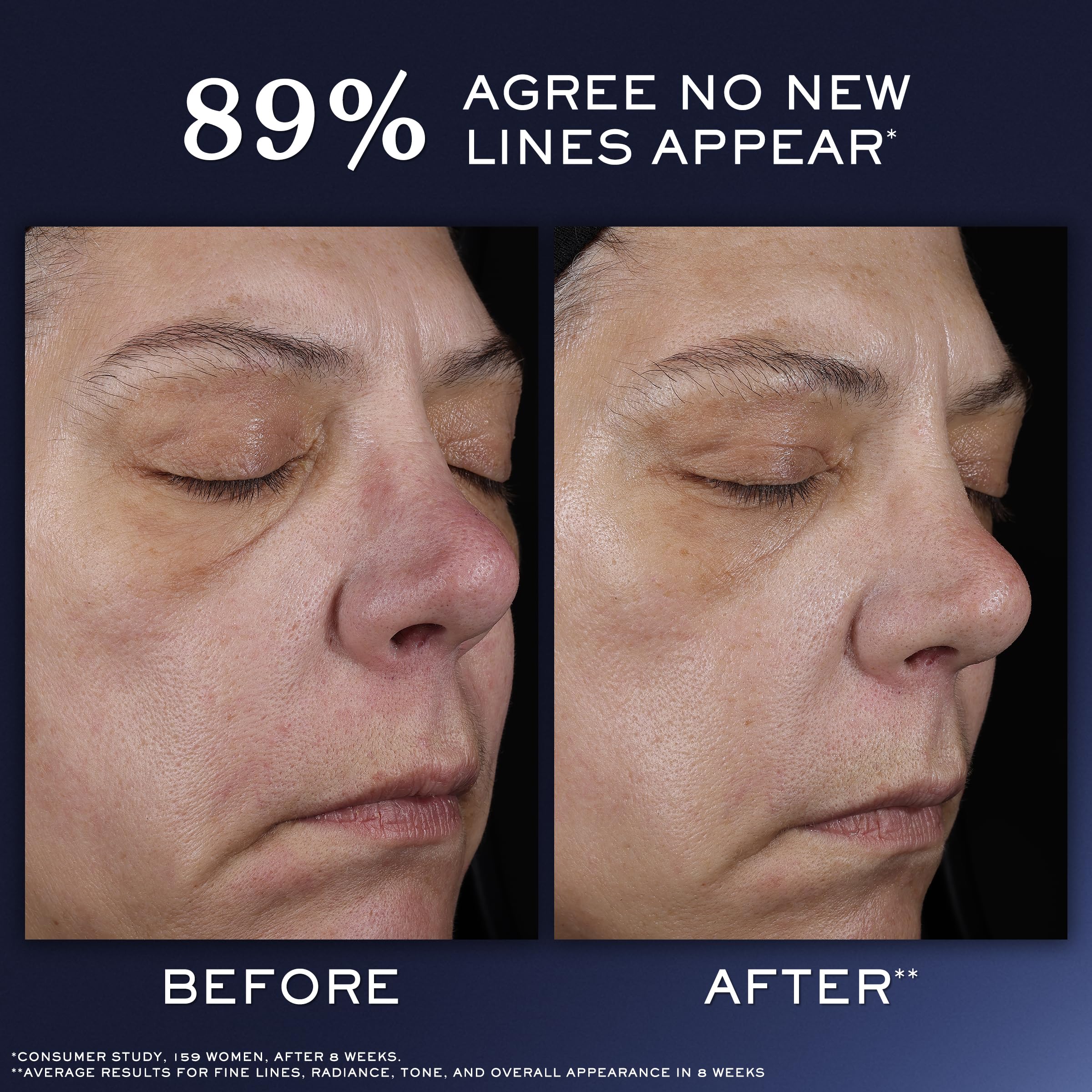Lancôme Génifique Ultimate Recovery Serum - Generic