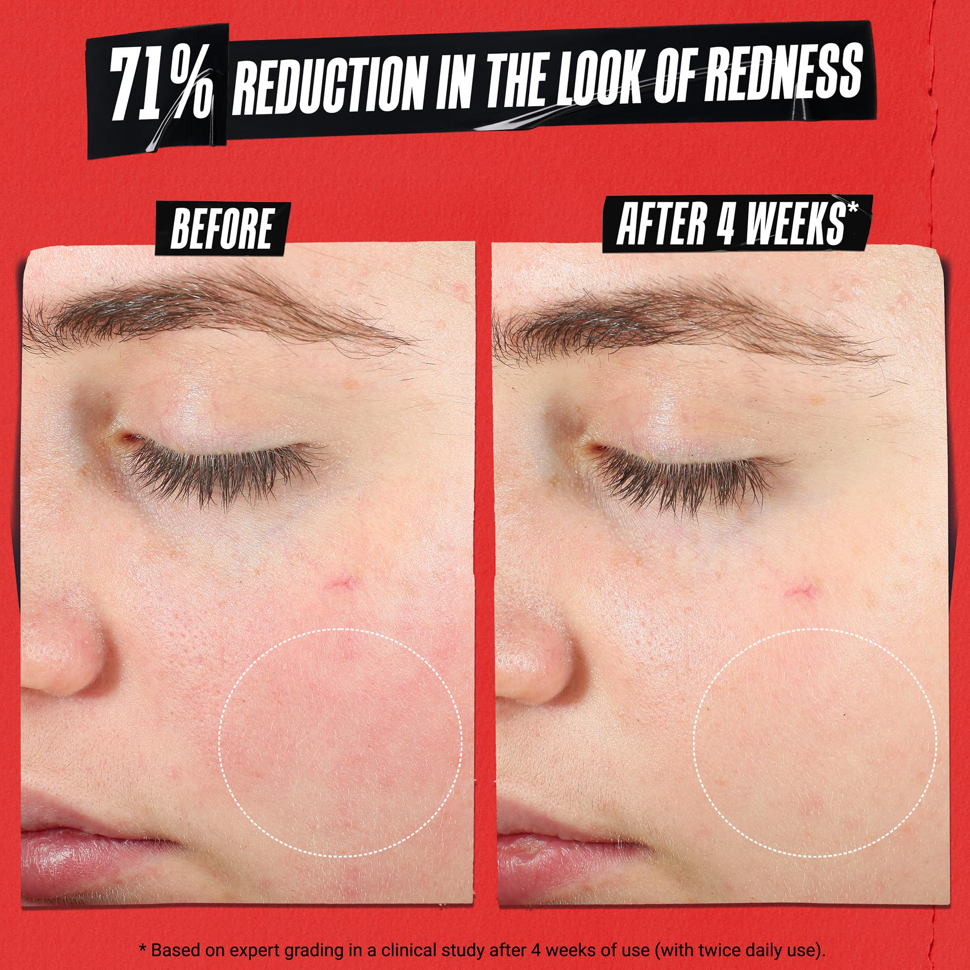 Elefair Tech Kiehl's - Ultra Facial Meltdown Recovery Barrier - Elefair Tech Official Product View 3