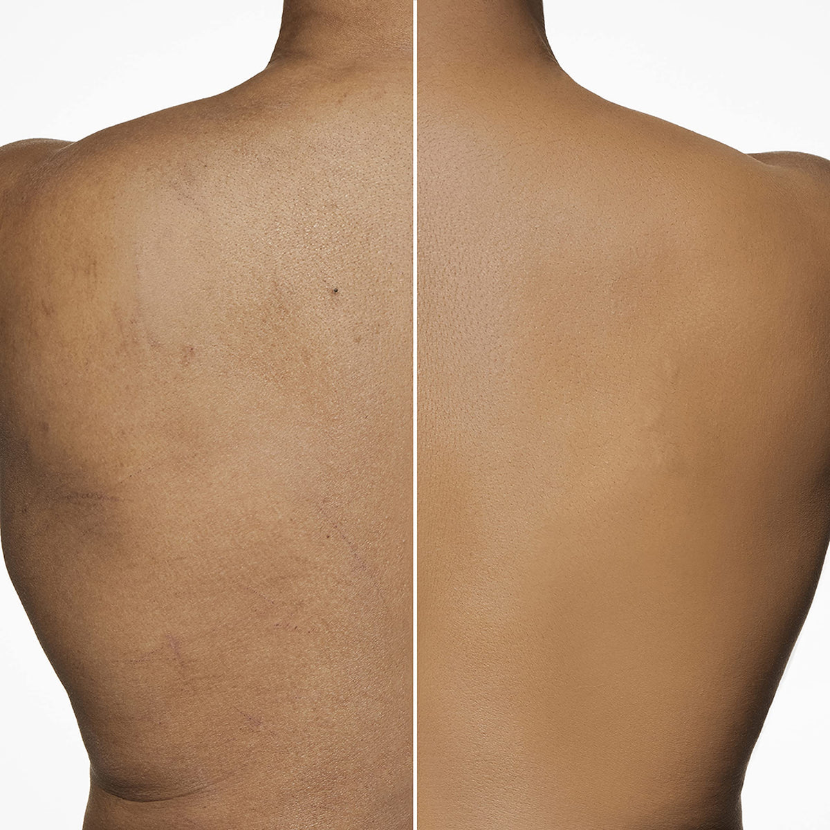 Dermablend Leg Body Makeup Foundation SPF 25 40N 3 4 fl oz - Dermablend Official Imagery - 8