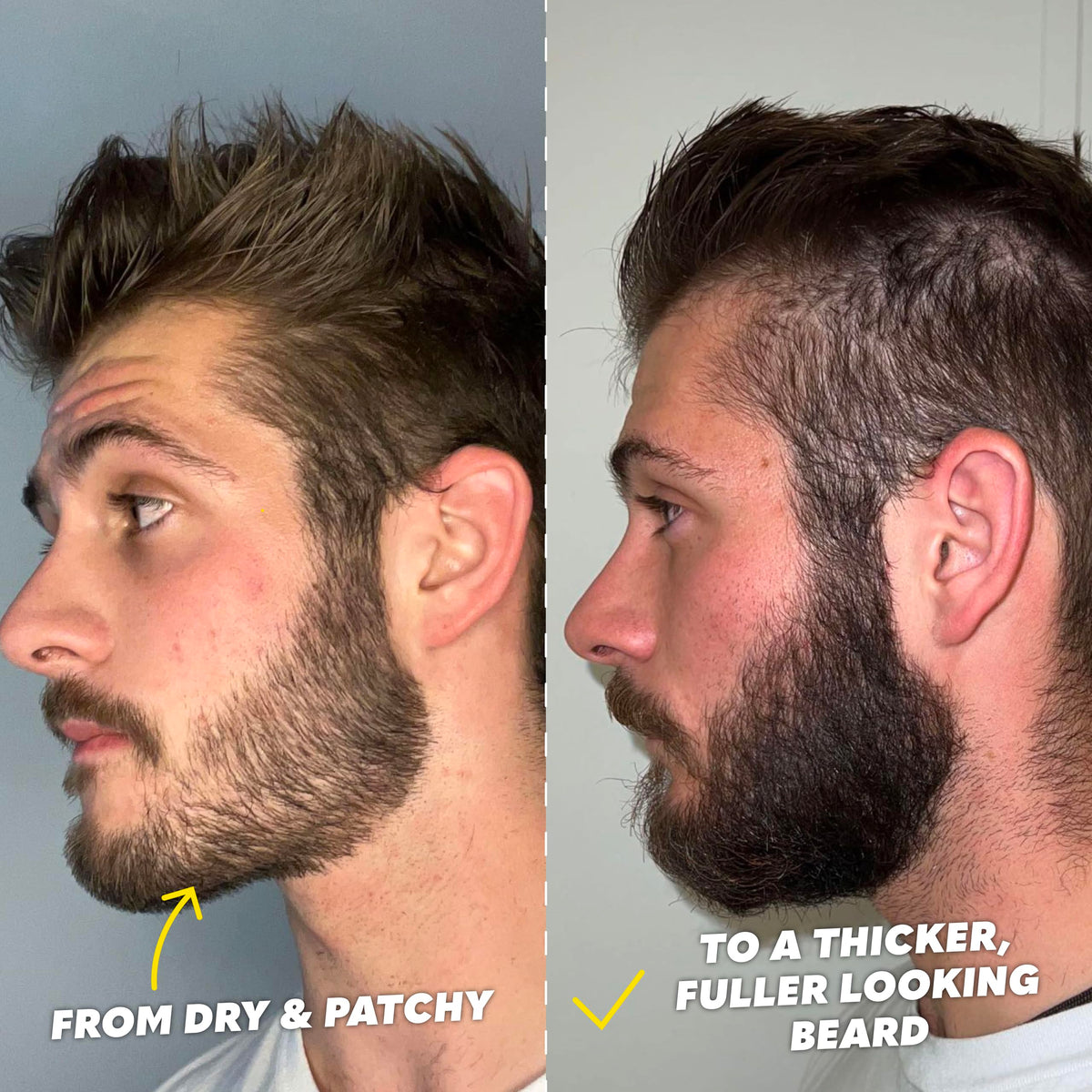 The Beard Club Signature Beard Growth Kit - The Beard Club Official Imagery - 7