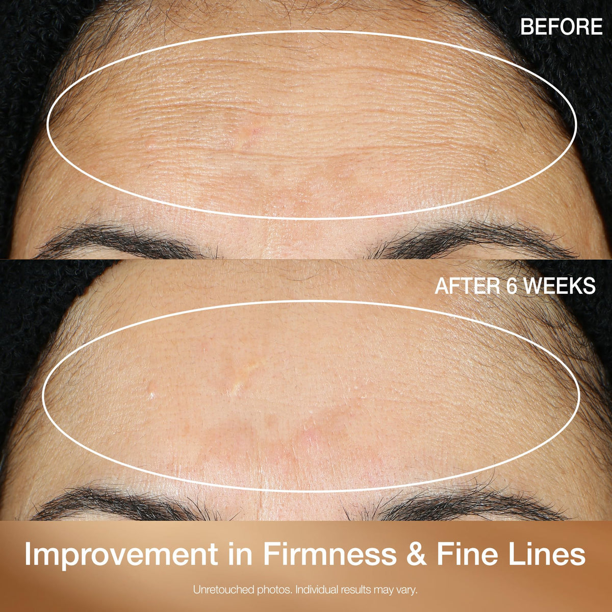 StriVectin Super C Retinol Brighten Correct Vitamin C Serum - Premium Selection Official Imagery - 5