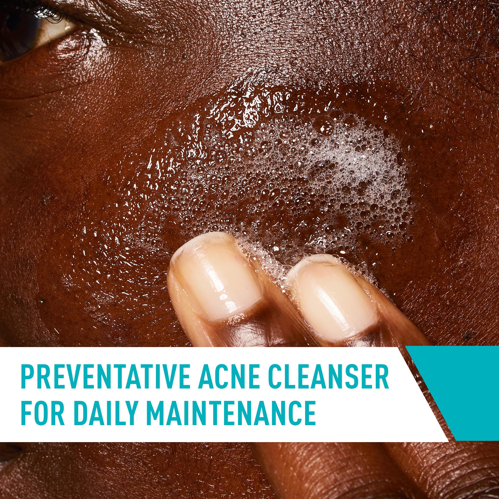 CeraVe Acne Control Cleanser, Face Wash with 2% Salicylic Acid - CeraVe Official Product View 5
