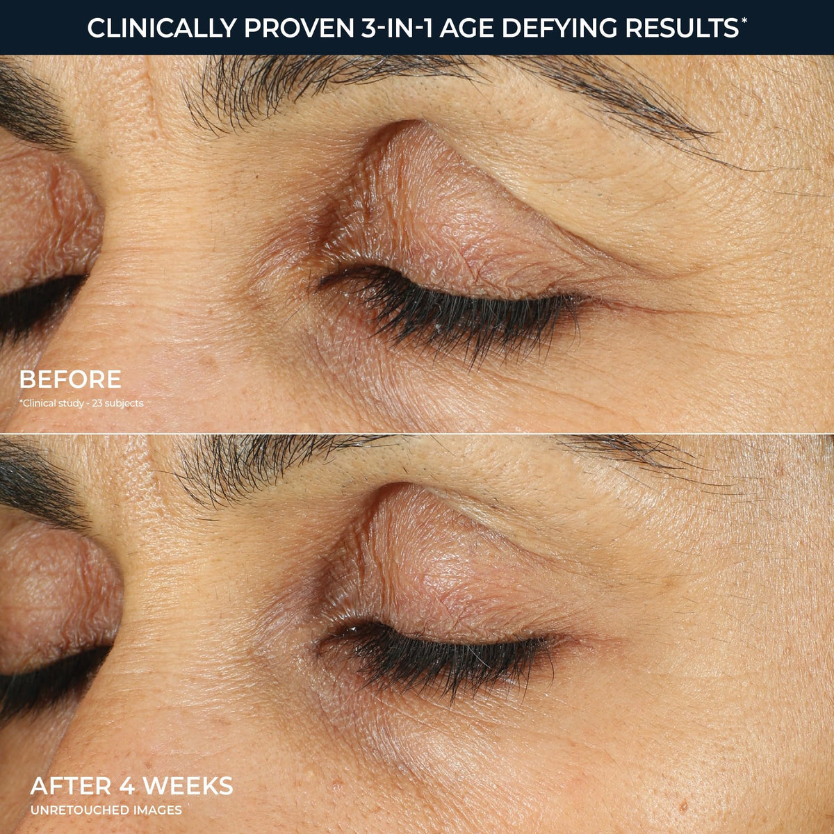 RoC Retinol Correxion Under Eye Cream for Dark Circles - RoC Official Imagery - 5
