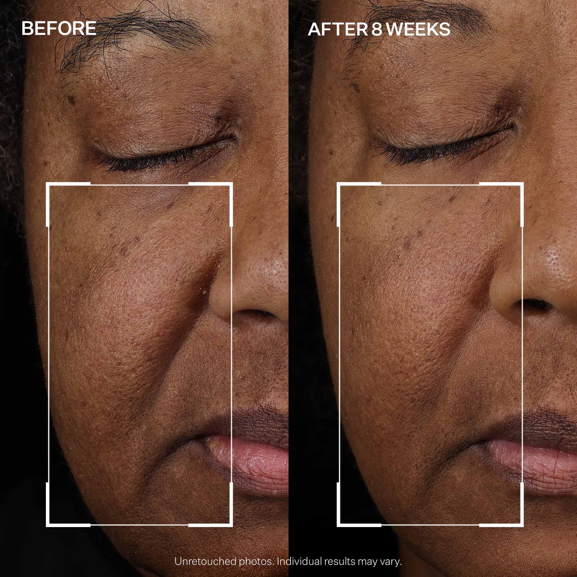 StriVectin Tighten & Lift Peptight Face Lift Serum with Tightening & Brightening Peptides for Wrinkles - Elefair Tech Official Product View 8