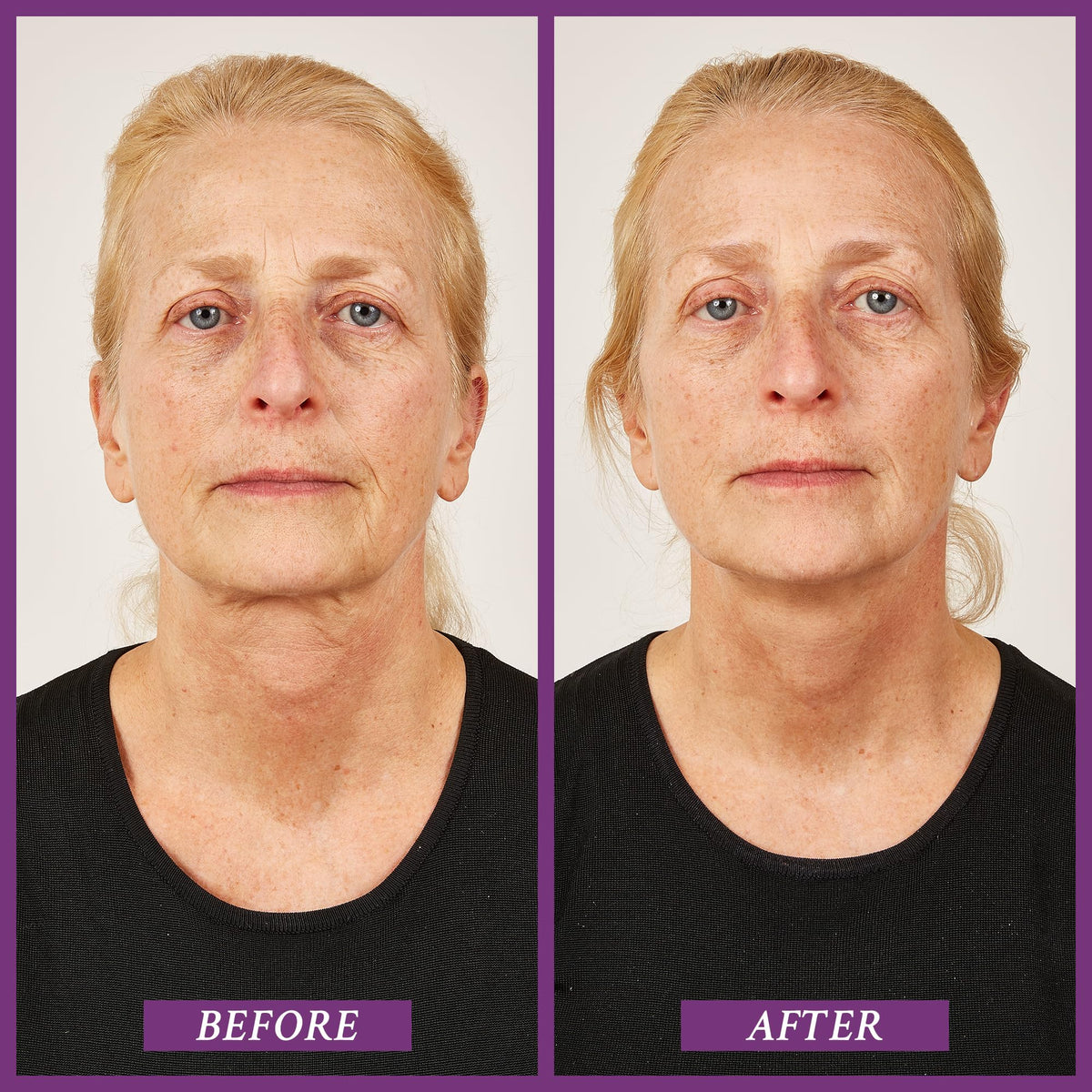 PRAI Beauty Ageless Throat Caviar Overnight Recovery Serum - PRAI Official Product Imagery - 4