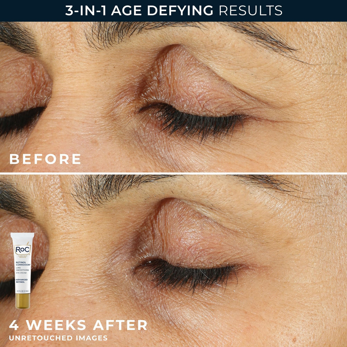 RoC Clinical Mini Retinol Anti Aging Skincare Routine Kit - RoC Official Imagery - 5