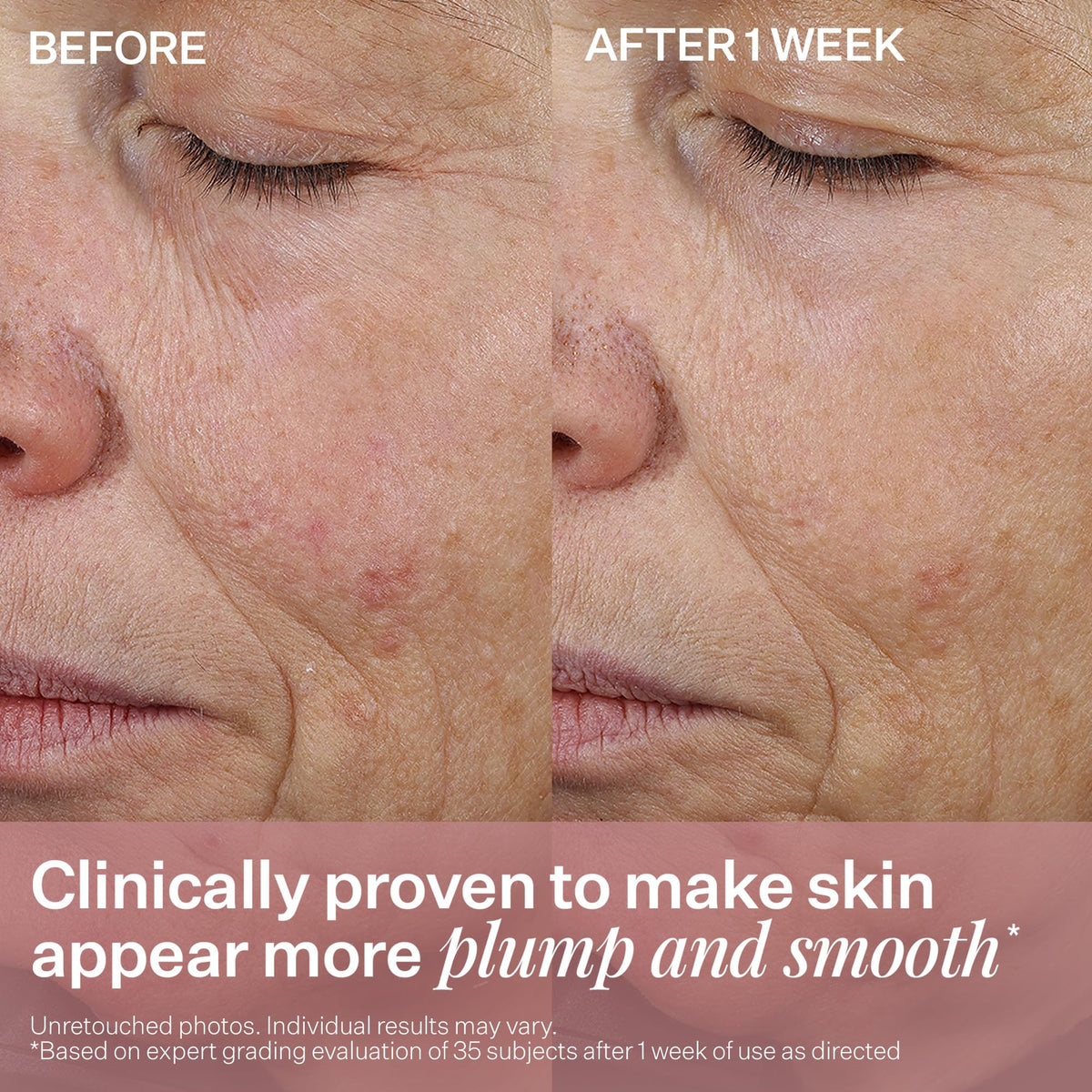 StriVectin Anti Wrinkle Peptide Plump Line Filling Bounce - Premium Selection Official Imagery - 7