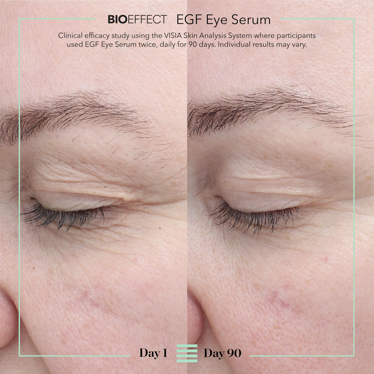 BIOEFFECT EGF Eye Serum Age Defying for Wrinkles Crow s Feet - Premium Selection Official Imagery - 4