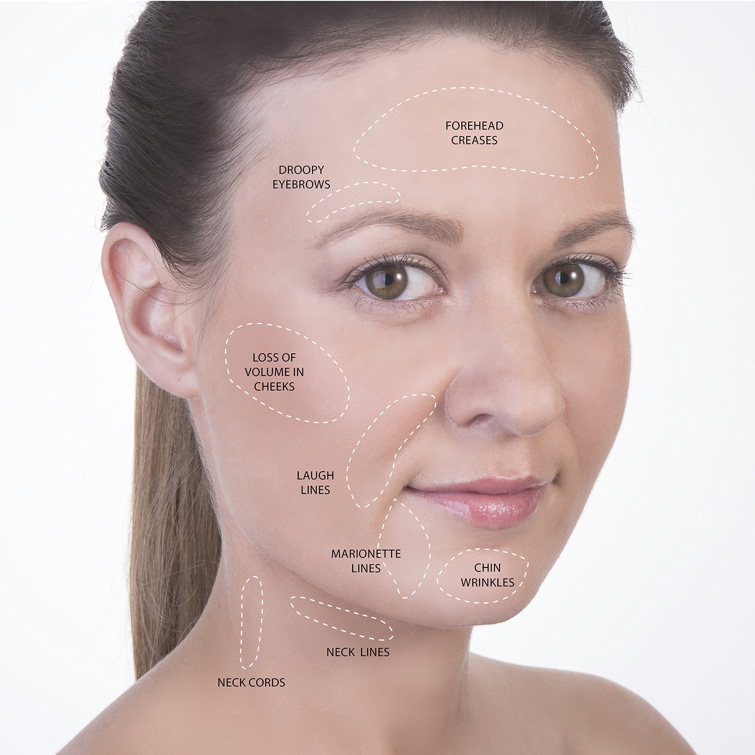 Face Cupping Set - SanDine Silky Skin