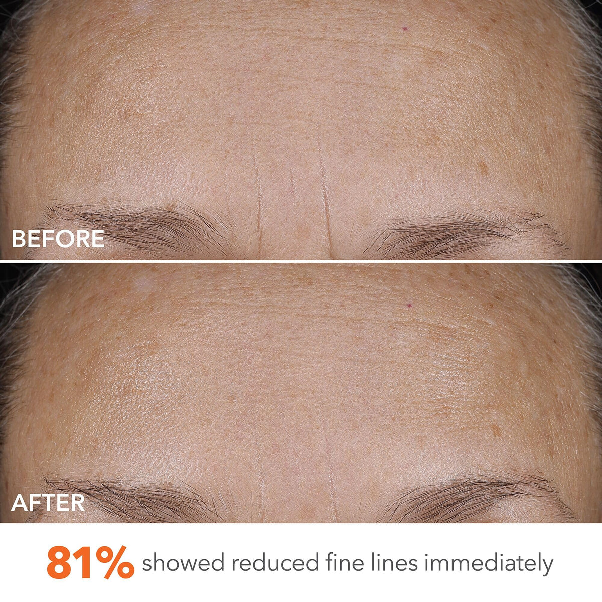 Dr Dennis Gross DermInfusions Blur Repair Cream Instantly - Dr Dennis Gross Official Imagery - 4