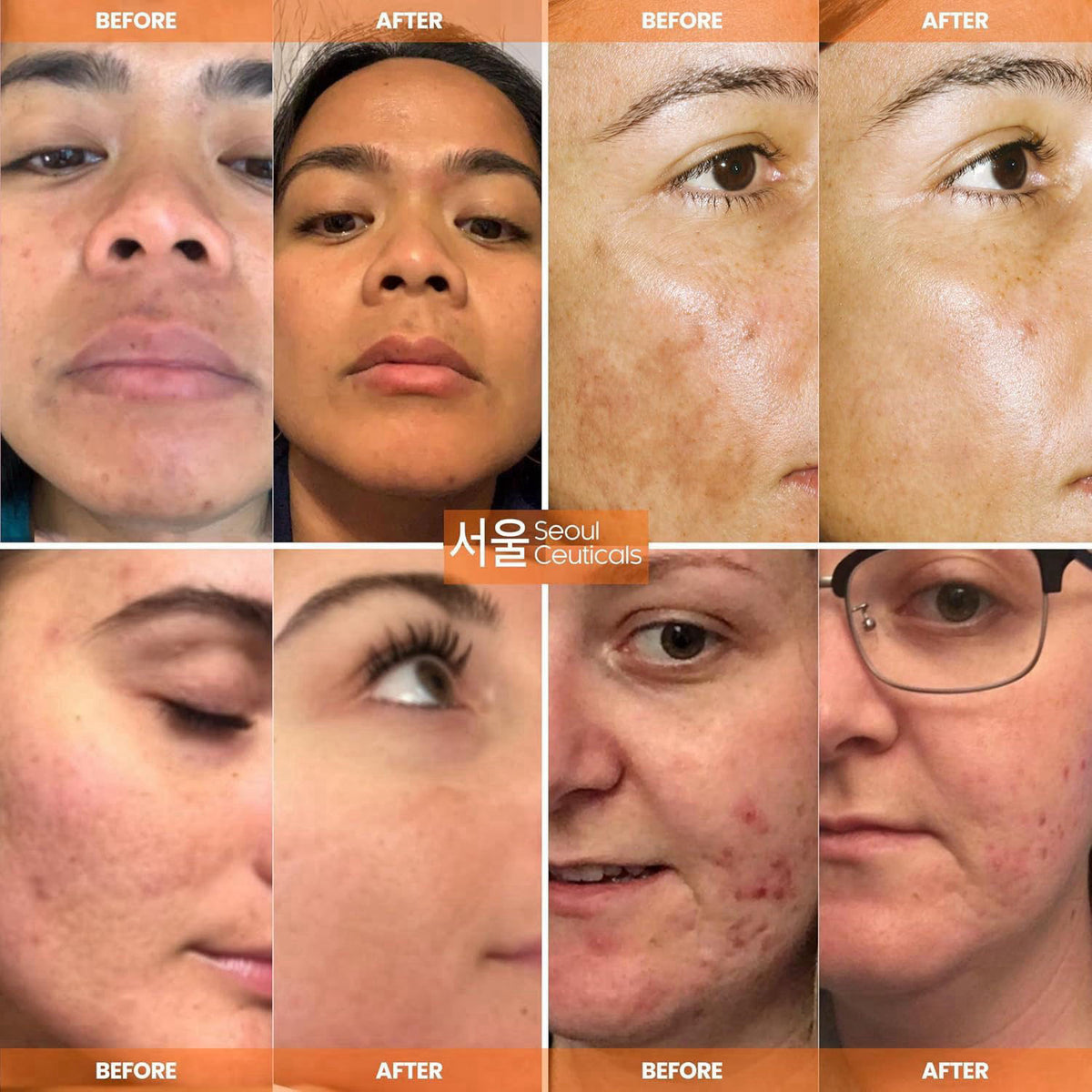 SeoulCeuticals Korean Skin Care 20 Vitamin C Serum for Face