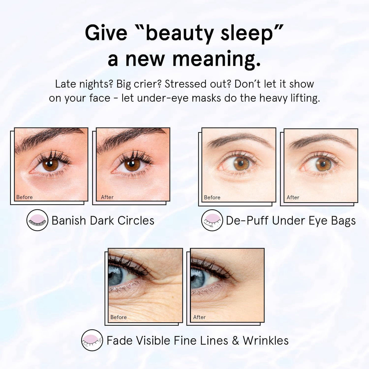 grace stella Retinol Under Eye Patches for Puffy Eyes