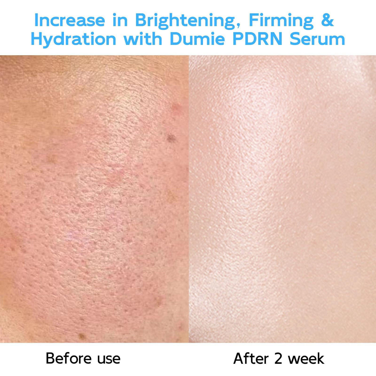 Salmon DNA PDRN Anti Aging Serum 5000ppm Salmon Egg DNA