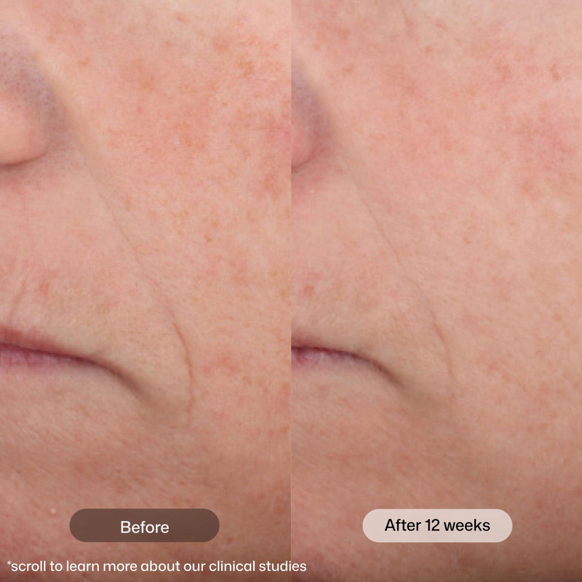Revision Skincare Intellishade Matte SPF 45 Tinted Sunscreen