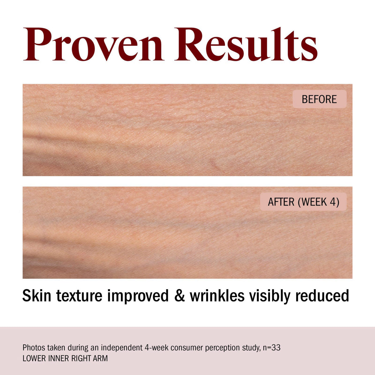 STRIPES Beauty — view 6