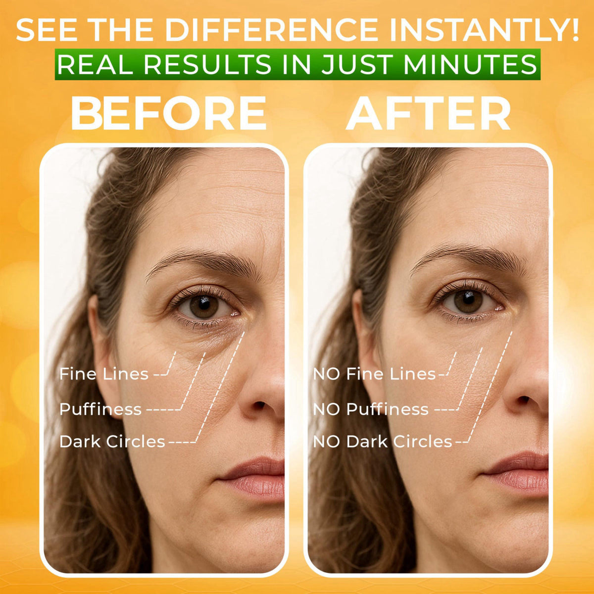Puffy Eye Treatment Instant results Naturally Eliminate