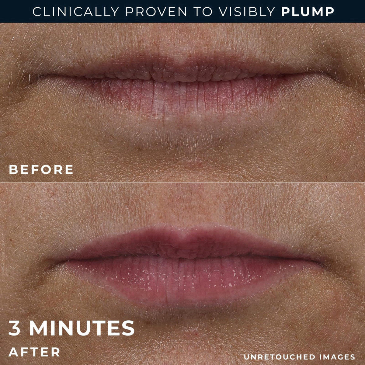 RoC Derm Correxion Lip Volumizer Hyaluronic Acid Lip Plumper