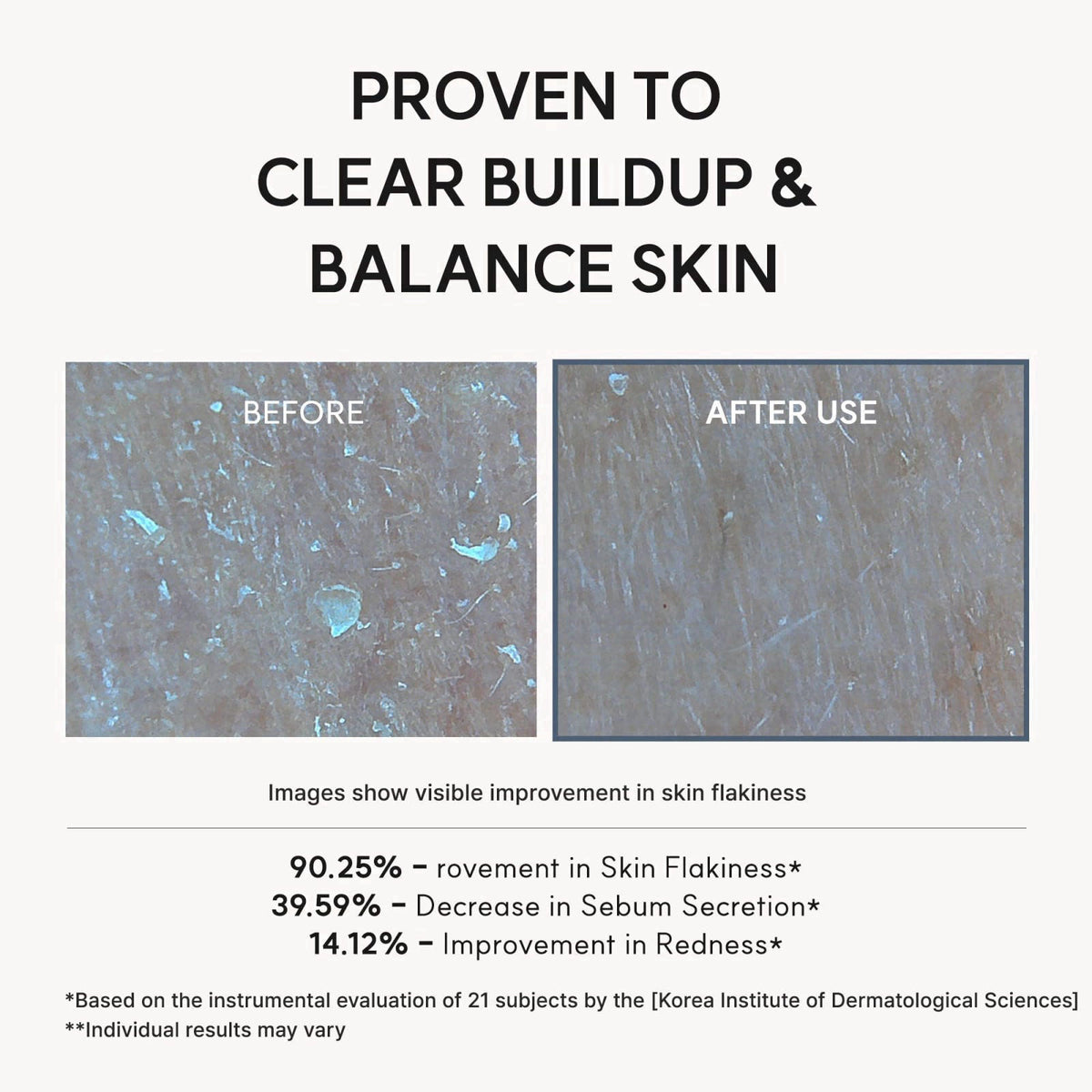 Arencia Eraser Shot Serum Glycolic Acid Booster with AHA BHA
