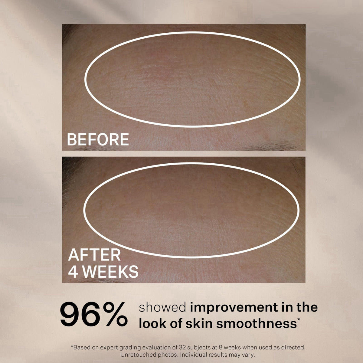 StriVectin Anti-Wrinkle Peptide Plump Line Filling Bounce Face Serum with Ceramides & Peptides for Firm Skin and Less Wr
