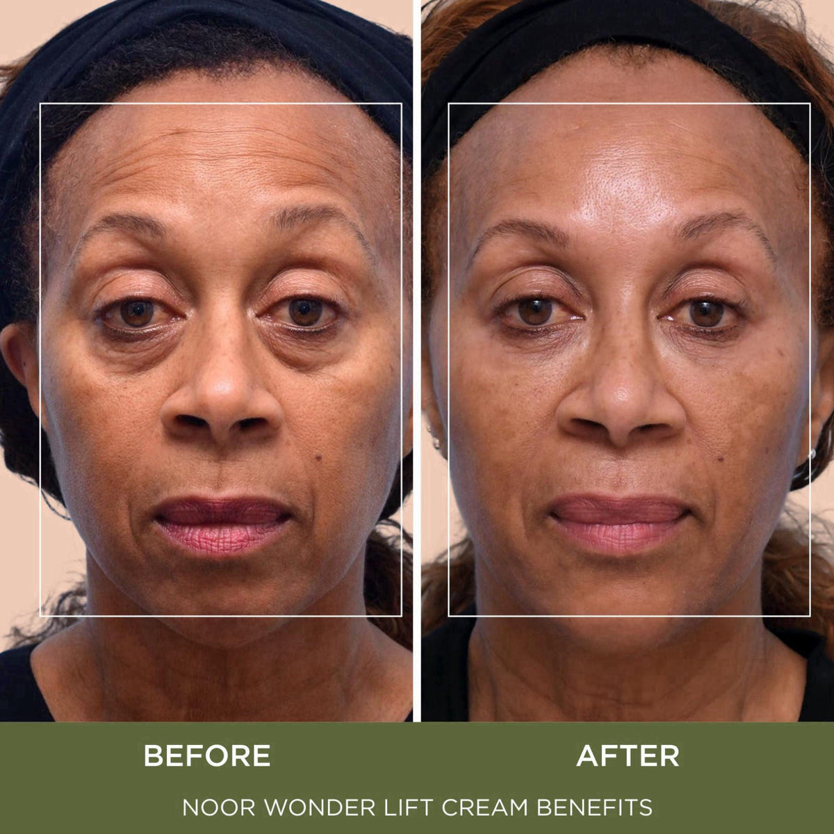 Noor Wonder Lift Cream for Women Natural Anti Aging Wrinkle