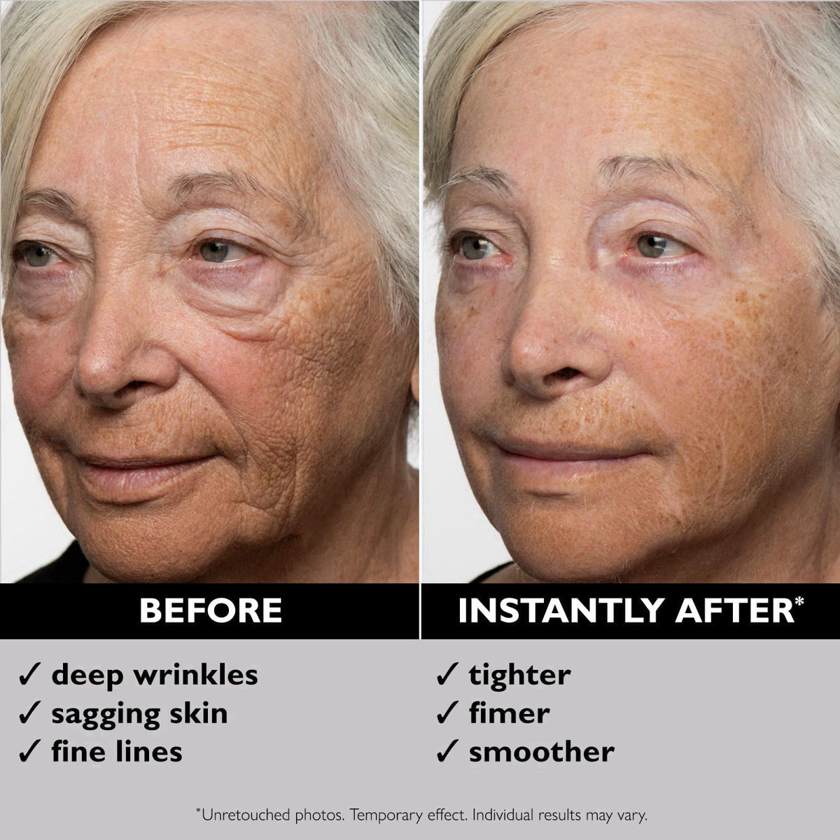 Peter Thomas Roth | Instant FIRMx® Temporary Face Tightener – full view