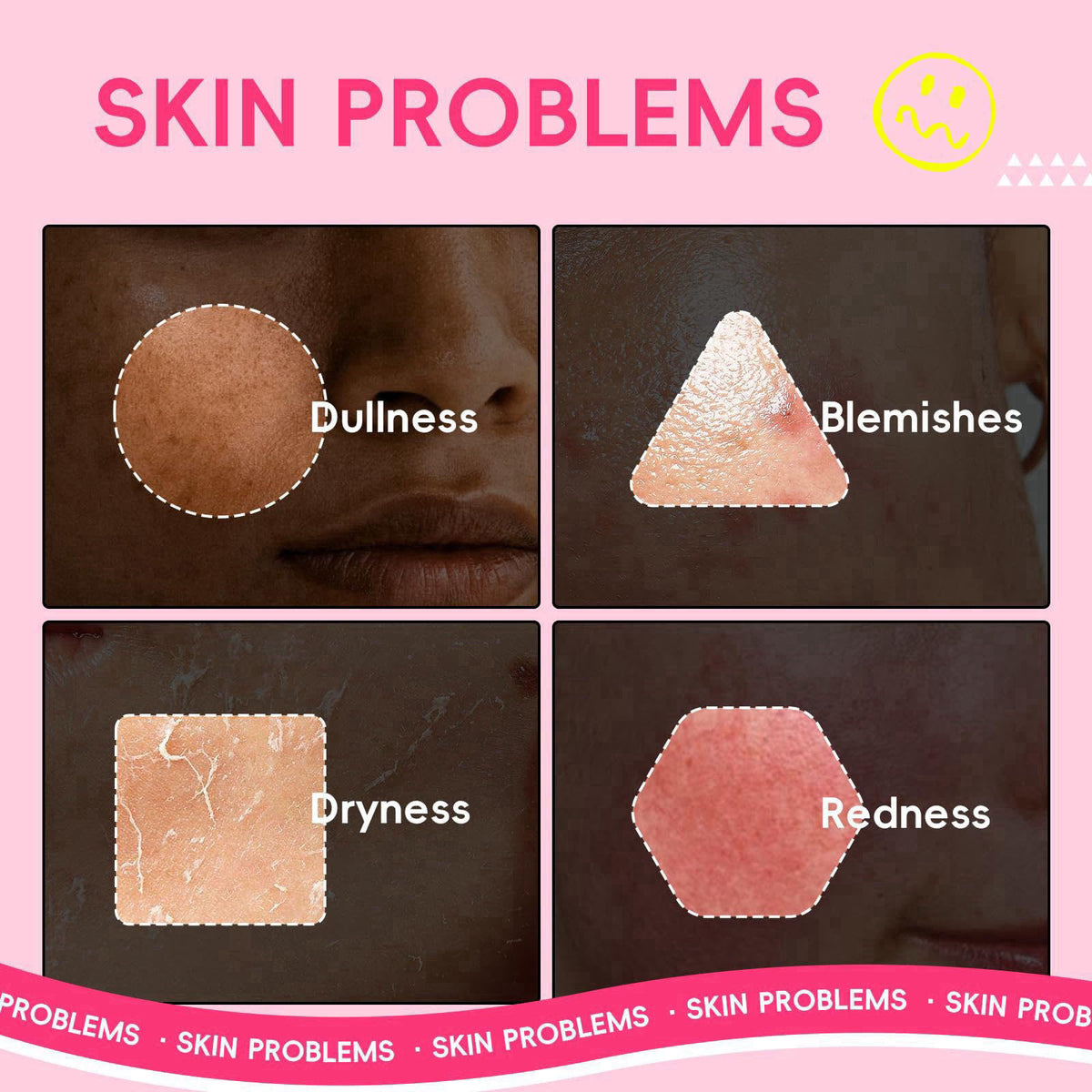 Watermelon Niacinamide Skincare Set for Women Teens Girls