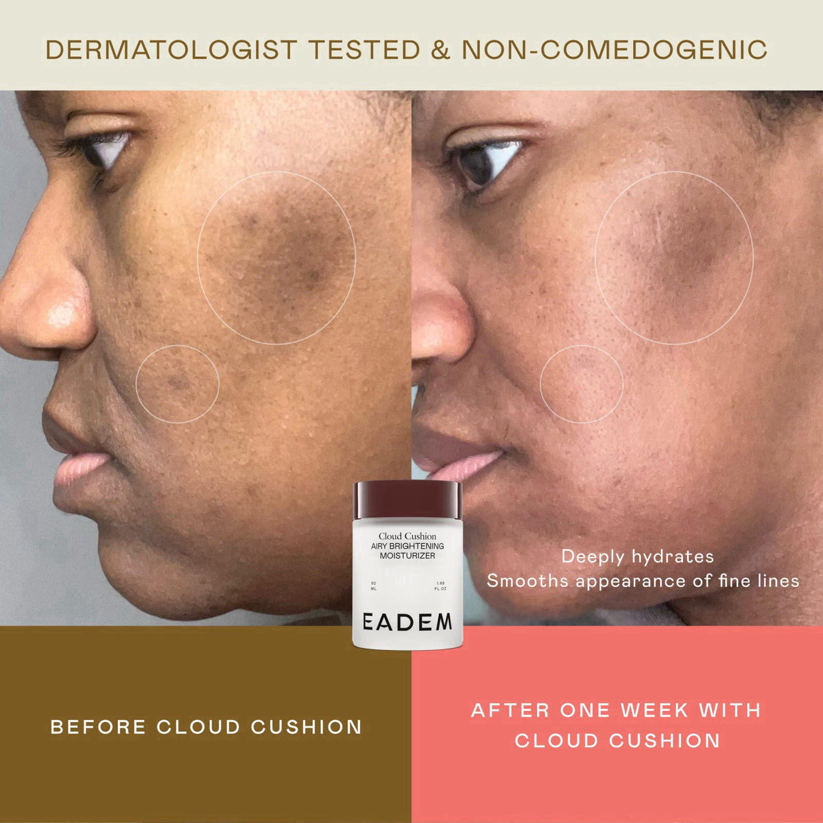 EADEM Face Moisturizer Barrier Repair Cream for Women, Cloud Cushion – full view