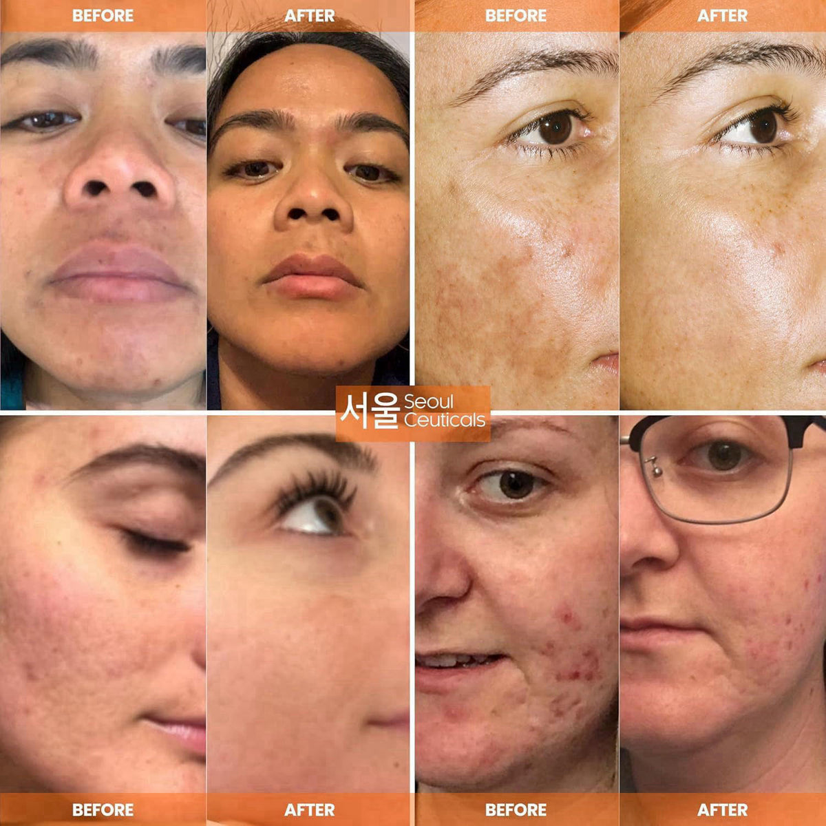 SeoulCeuticals Korean Skin Care 20 Vitamin C Serum for Face