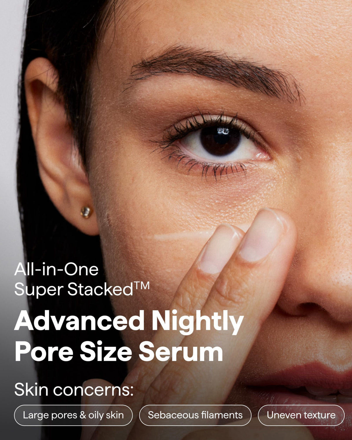 REMEDY for Pore Size Pore Refining Advanced Serum for by Remedy Science — view 3