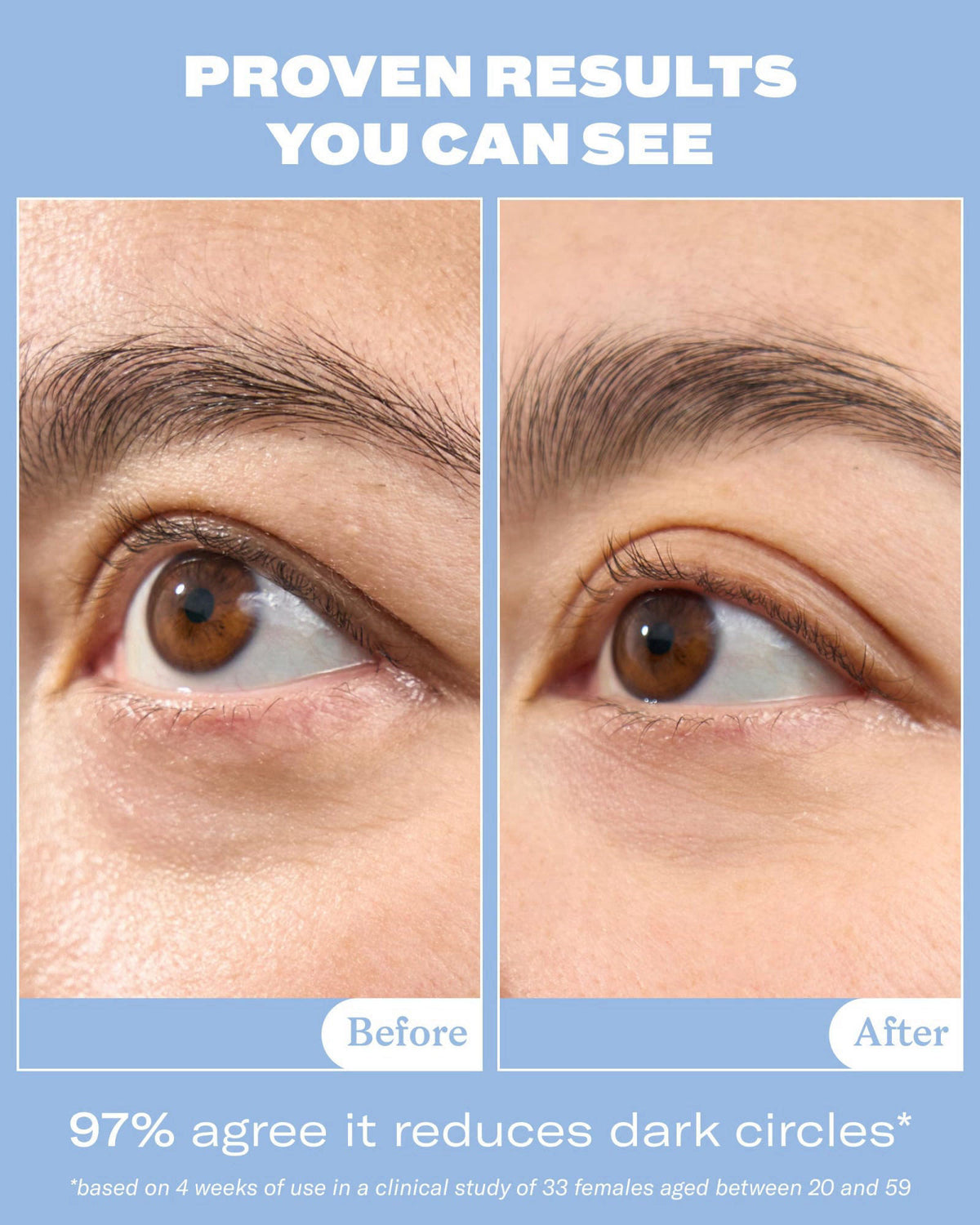 Then I Met You Snail Mucin Eye Cream Korean Skin Care With