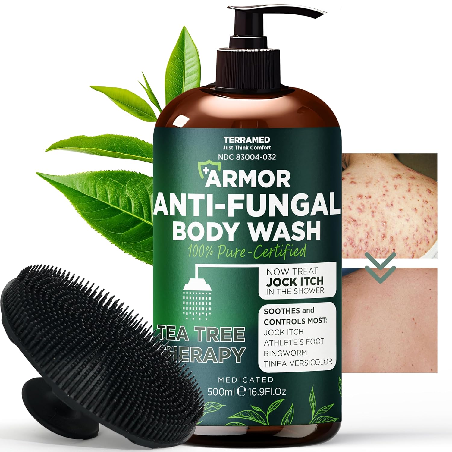 Antifungal Body Wash with Tea Tree Oil | Antifungal Soap for Back Acne
