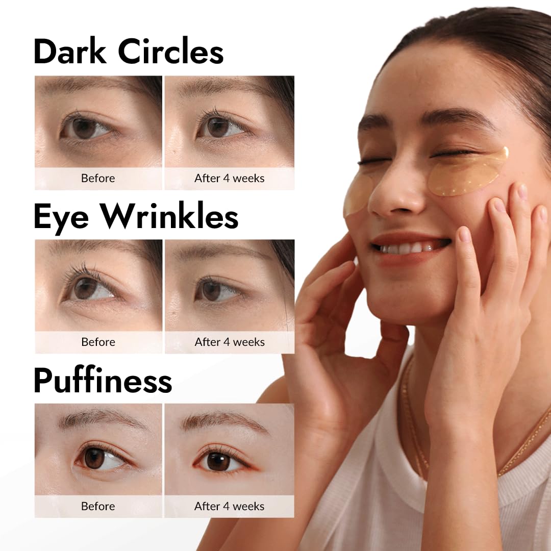 MIZON Under Eye Patches for Puffy Eyes & Dark Circles, 24K Gold & Snail Mucin