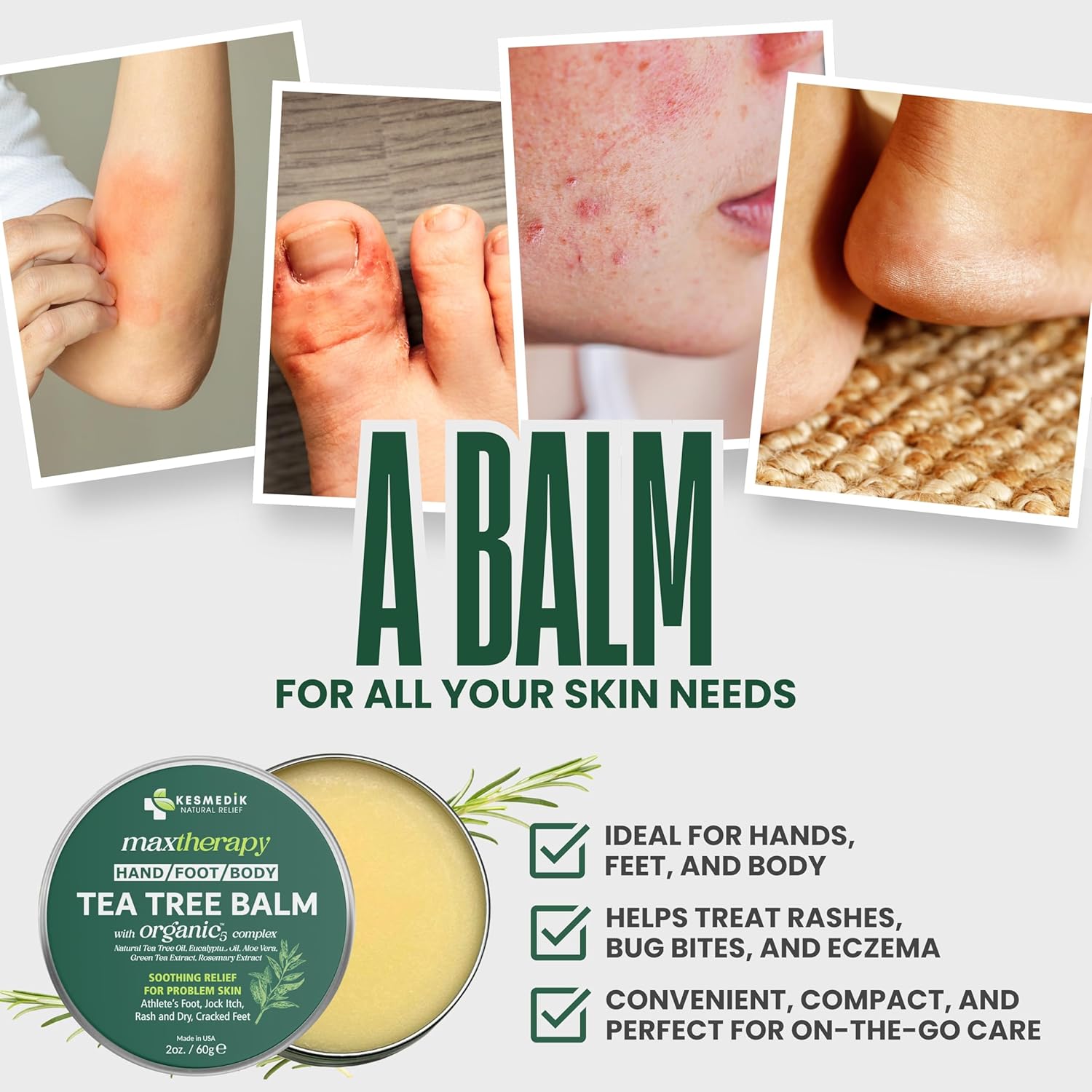 Tea Tree Oil Balm for Skin, Soothes Itching, Rashes & Dry Skin, Antifungal
