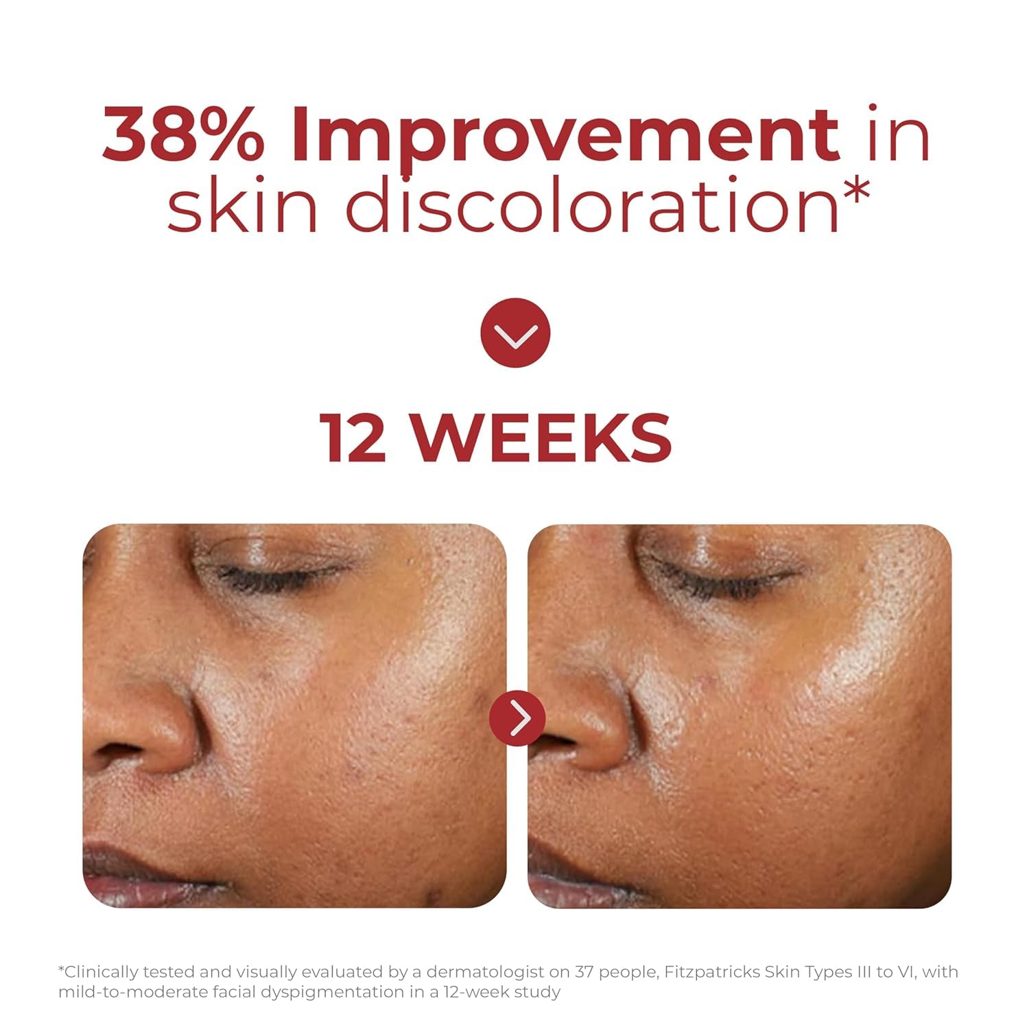 Elefair EltaMD UV Clear SPF 46 oil-free face sunscreen with zinc oxide, dermatologist recommended, in a white tube.