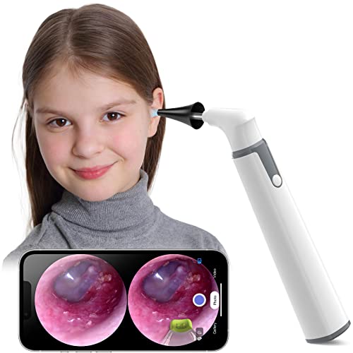 WiFi Otoscope HD Otoscope Camera with Light Ear Checker for